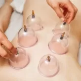 dry cupping pain relief Ponchatoula, Livingston, LA